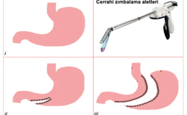 The Continuous Surgical Stapler developed by Sabancı University won first prize in the 8th Surgical Research Congress held by the Turkish Surgical Society